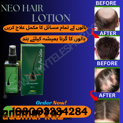 Nair Hair Removal Spray in Pakistan Islamabad #03003334284