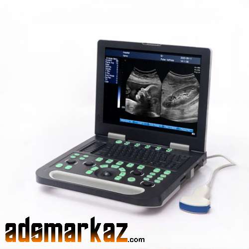 Brand new N50 Notebook 15" LED Ultrasound machine|Surgical Hut