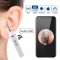 Wireless WiFi Otoscope Ear Camera Earwax Removal Tool|Surgical hut